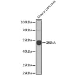 Western Blot - Anti-GRINA Antibody (A91545) - Antibodies.com