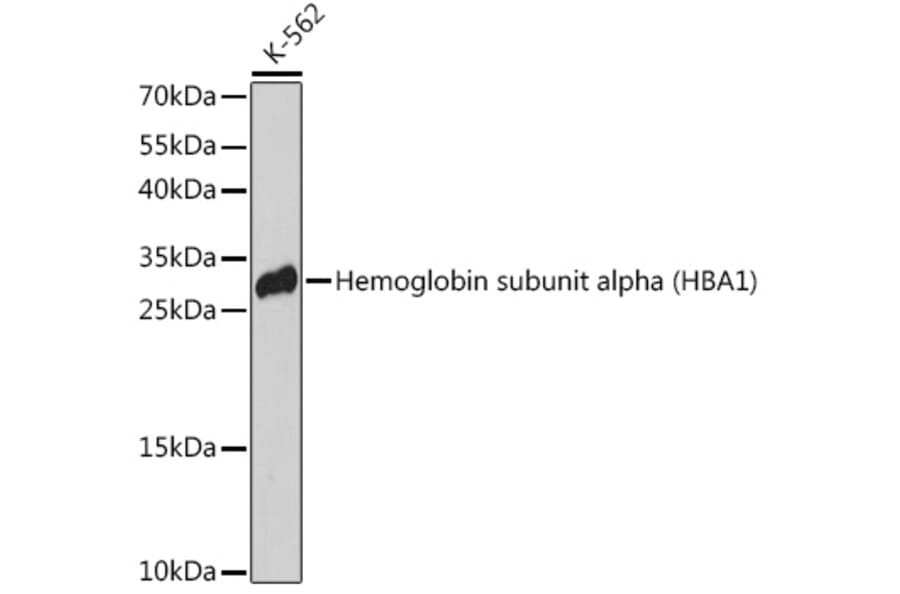 Western Blot - Anti-Hemoglobin subunit alpha Antibody (A91546) - Antibodies.com