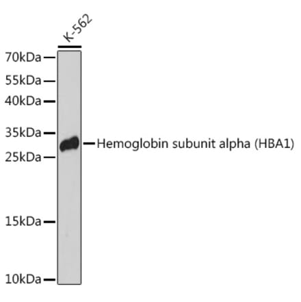 Western Blot - Anti-Hemoglobin subunit alpha Antibody (A91546) - Antibodies.com