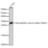 Western Blot - Anti-Hemoglobin subunit alpha Antibody (A91546) - Antibodies.com
