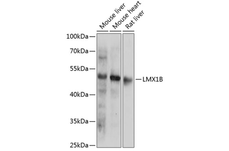 Western Blot - Anti-LMX1b Antibody (A91547) - Antibodies.com