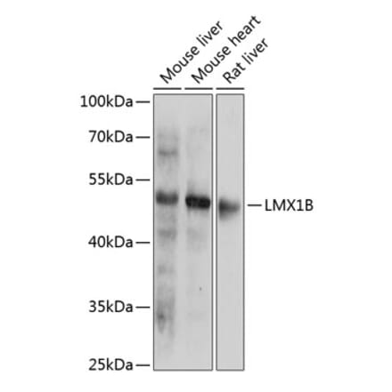 Western Blot - Anti-LMX1b Antibody (A91547) - Antibodies.com
