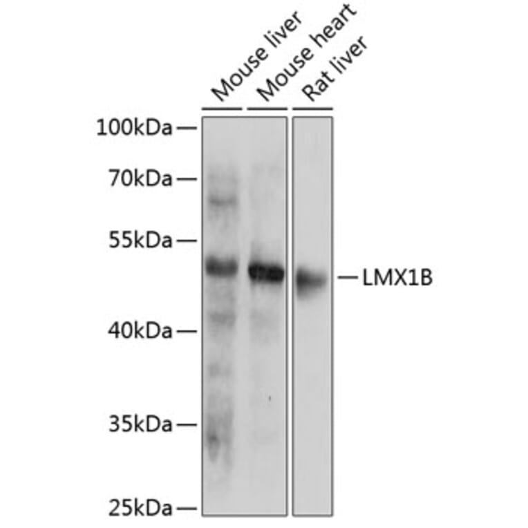 Western Blot - Anti-LMX1b Antibody (A91547) - Antibodies.com