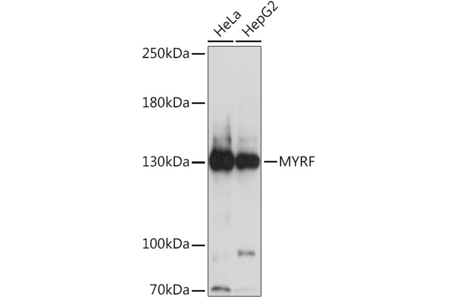 Western Blot - Anti-MRF Antibody (A91549) - Antibodies.com