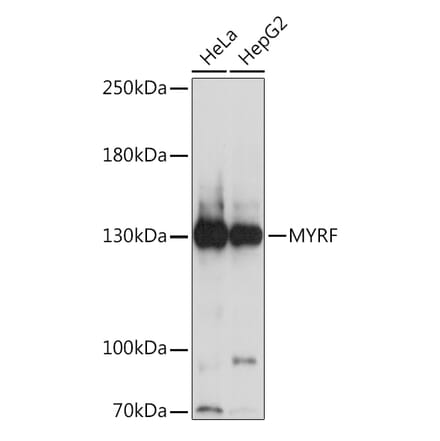 Western Blot - Anti-MRF Antibody (A91549) - Antibodies.com