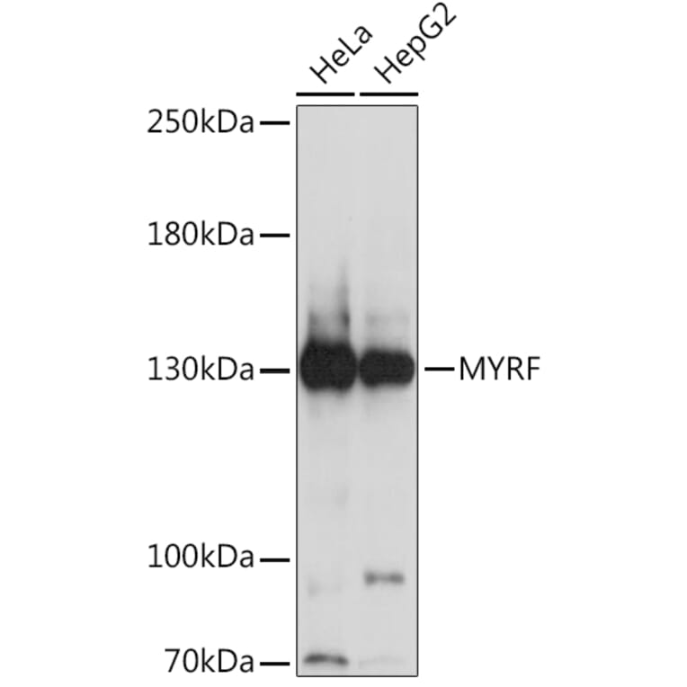 Western Blot - Anti-MRF Antibody (A91549) - Antibodies.com