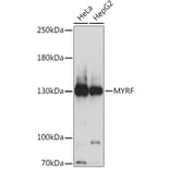 Western Blot - Anti-MRF Antibody (A91549) - Antibodies.com