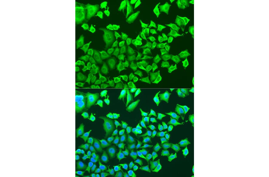 Immunofluorescence - Anti-PRKAB1 Antibody (A15708) - Antibodies.com