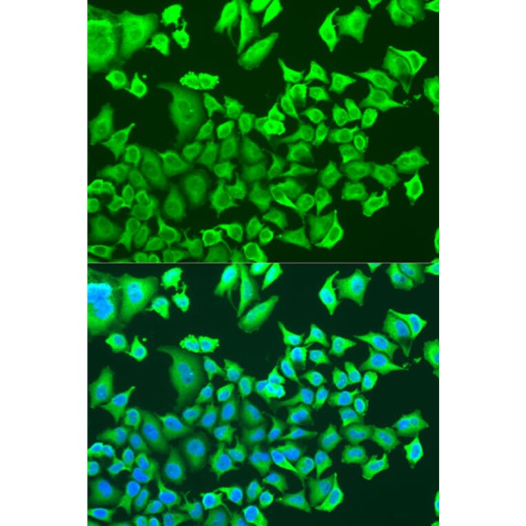 Immunofluorescence - Anti-PRKAB1 Antibody (A15708) - Antibodies.com
