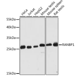 Western Blot - Anti-RanBP1 Antibody (A91551) - Antibodies.com