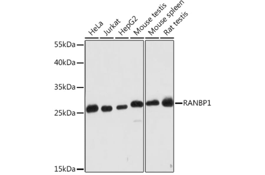 Western Blot - Anti-RanBP1 Antibody (A91551) - Antibodies.com