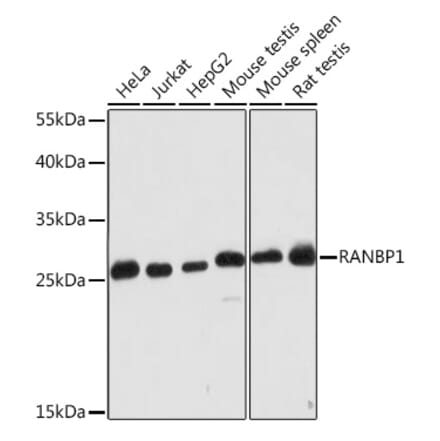 Western Blot - Anti-RanBP1 Antibody (A91551) - Antibodies.com