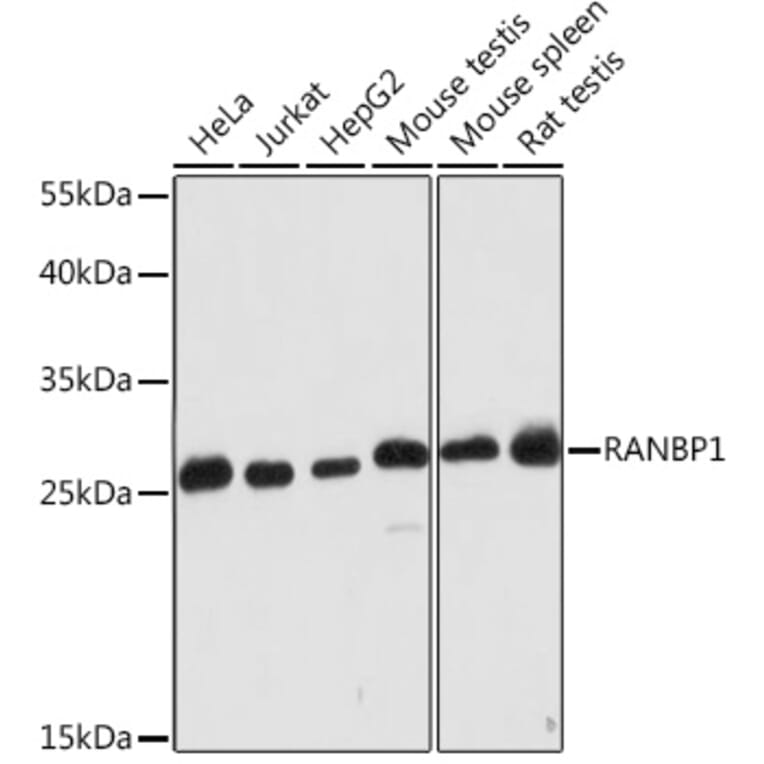 Western Blot - Anti-RanBP1 Antibody (A91551) - Antibodies.com