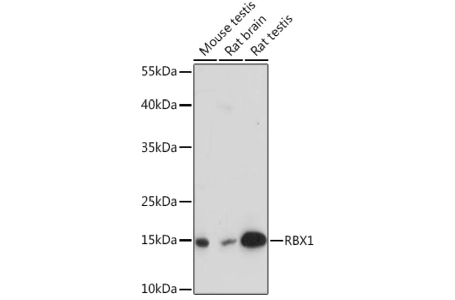 Western Blot - Anti-RBX1 Antibody (A91552) - Antibodies.com