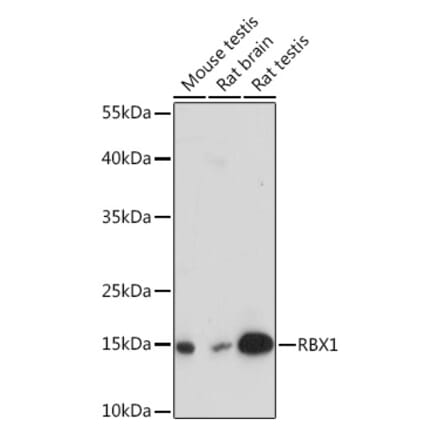 Western Blot - Anti-RBX1 Antibody (A91552) - Antibodies.com