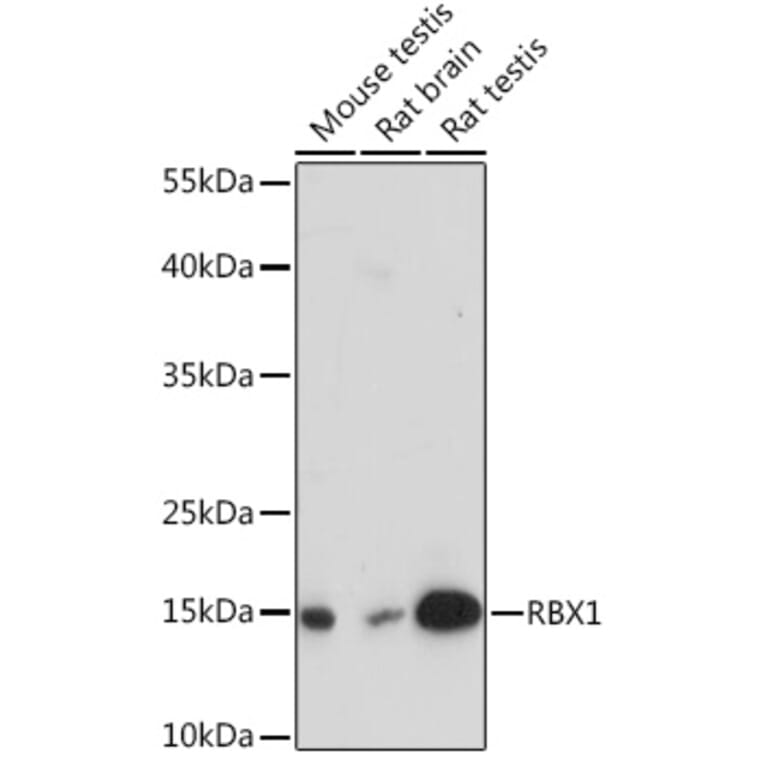 Western Blot - Anti-RBX1 Antibody (A91552) - Antibodies.com