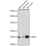 Western Blot - Anti-RBX1 Antibody (A91552) - Antibodies.com