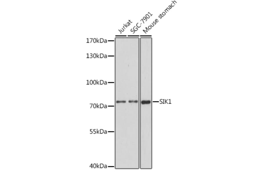 Western Blot - Anti-SIK1 Antibody (A91554) - Antibodies.com