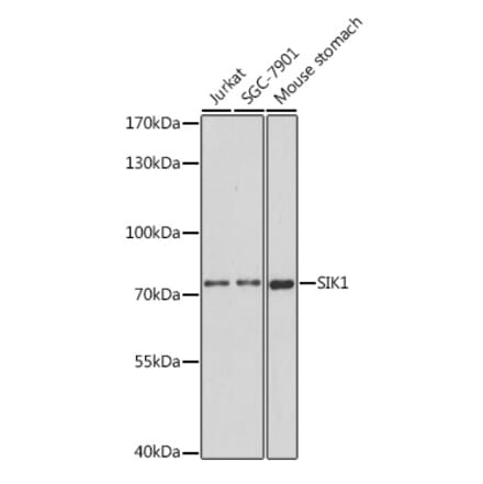 Western Blot - Anti-SIK1 Antibody (A91554) - Antibodies.com