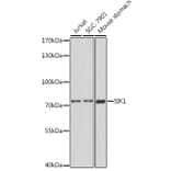 Western Blot - Anti-SIK1 Antibody (A91554) - Antibodies.com