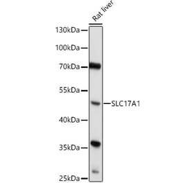 Western Blot - Anti-SLC17A1 Antibody (A91555) - Antibodies.com