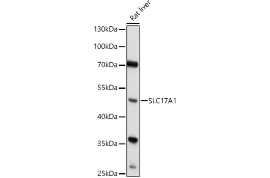 Western Blot - Anti-SLC17A1 Antibody (A91555) - Antibodies.com