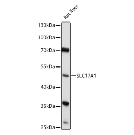Western Blot - Anti-SLC17A1 Antibody (A91555) - Antibodies.com