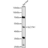 Western Blot - Anti-SLC17A1 Antibody (A91555) - Antibodies.com