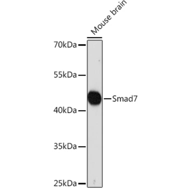 Western Blot - Anti-MADH7 / SMAD7 Antibody (A91556) - Antibodies.com