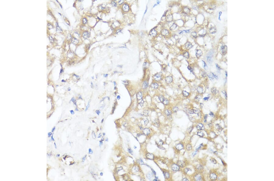 Immunohistochemistry - Anti-MADH7 / SMAD7 Antibody (A91556) - Antibodies.com
