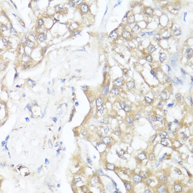 Immunohistochemistry - Anti-MADH7 / SMAD7 Antibody (A91556) - Antibodies.com