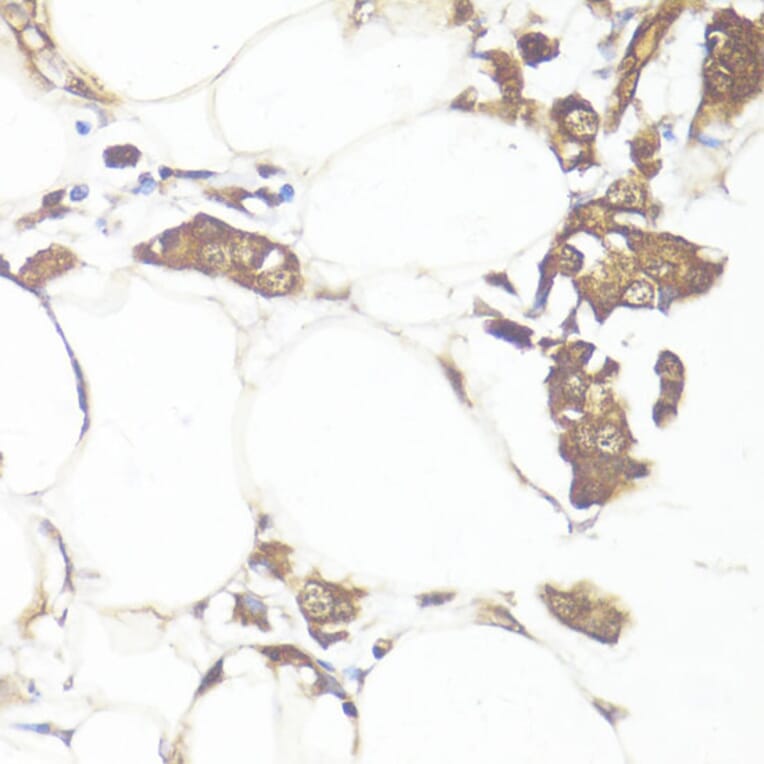 Immunohistochemistry - Anti-MADH7 / SMAD7 Antibody (A91556) - Antibodies.com