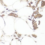 Immunohistochemistry - Anti-MADH7 / SMAD7 Antibody (A91556) - Antibodies.com