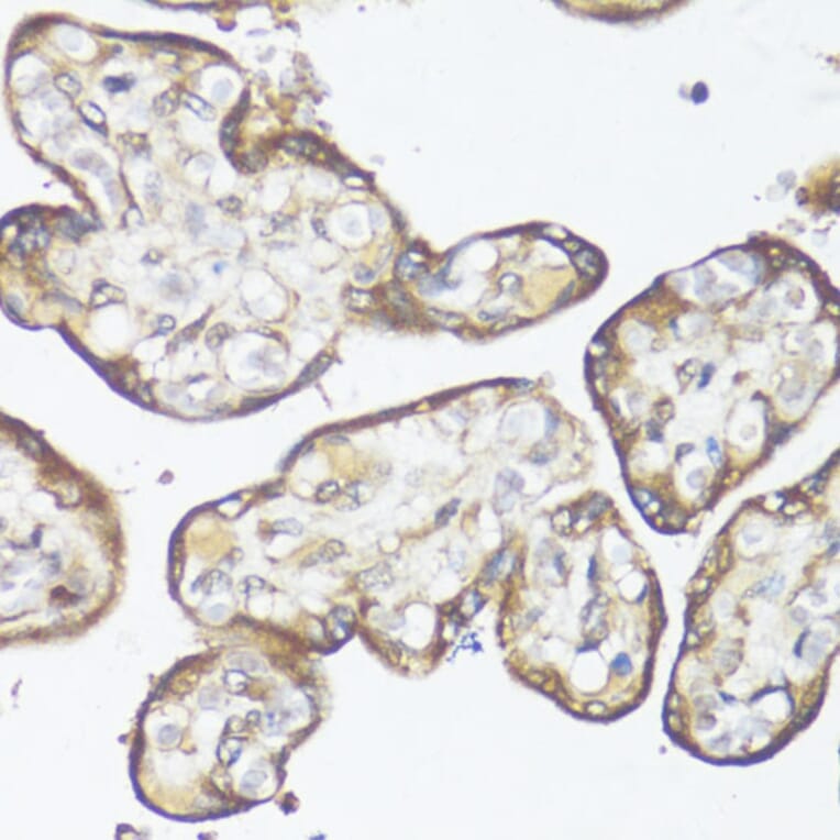 Immunohistochemistry - Anti-MADH7 / SMAD7 Antibody (A91556) - Antibodies.com