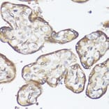 Immunohistochemistry - Anti-MADH7 / SMAD7 Antibody (A91556) - Antibodies.com