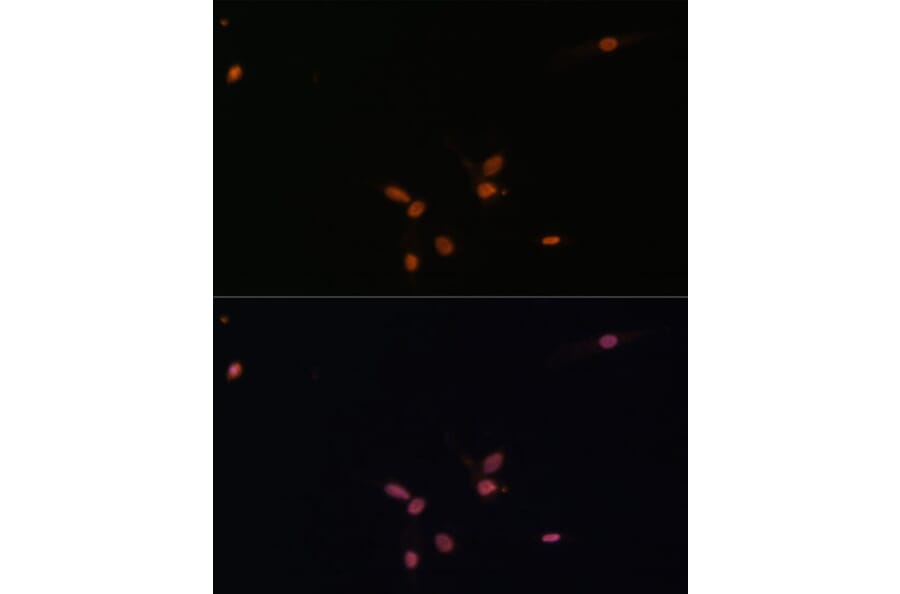Immunofluorescence - Anti-MADH7 / SMAD7 Antibody (A91556) - Antibodies.com
