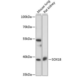 Western Blot - Anti-SOX18 Antibody (A91557) - Antibodies.com