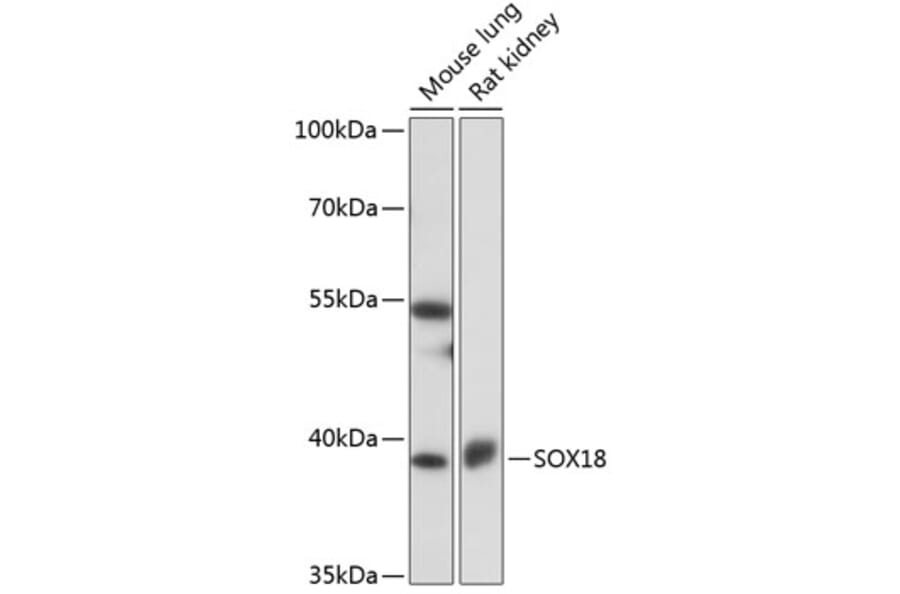 Western Blot - Anti-SOX18 Antibody (A91557) - Antibodies.com