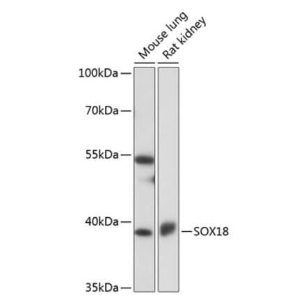 Western Blot - Anti-SOX18 Antibody (A91557) - Antibodies.com