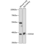 Western Blot - Anti-SOX18 Antibody (A91557) - Antibodies.com