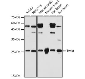 Western Blot - Anti-Twist Antibody (A91562) - Antibodies.com