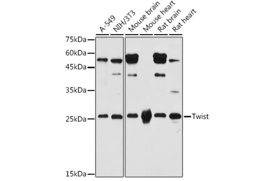 Western Blot - Anti-Twist Antibody (A91562) - Antibodies.com