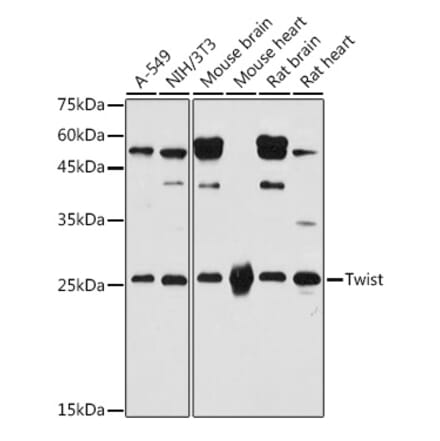 Western Blot - Anti-Twist Antibody (A91562) - Antibodies.com