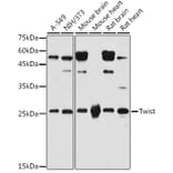 Western Blot - Anti-Twist Antibody (A91562) - Antibodies.com