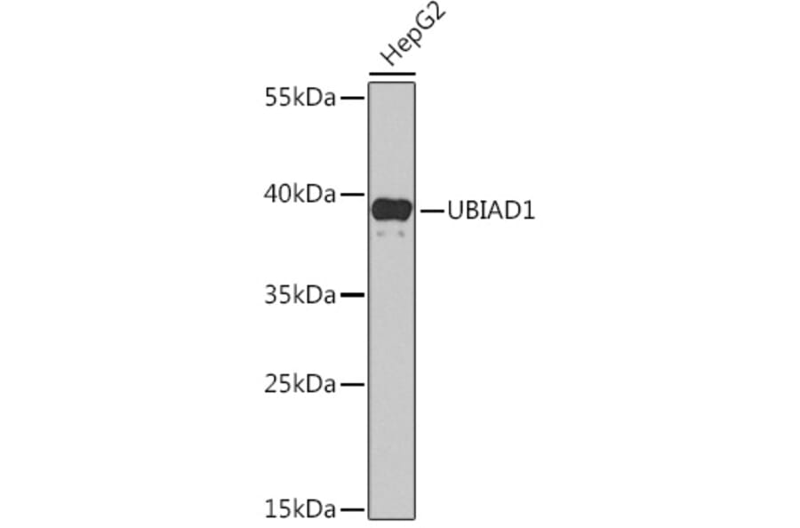 Western Blot - Anti-UBIAD1 Antibody (A91563) - Antibodies.com