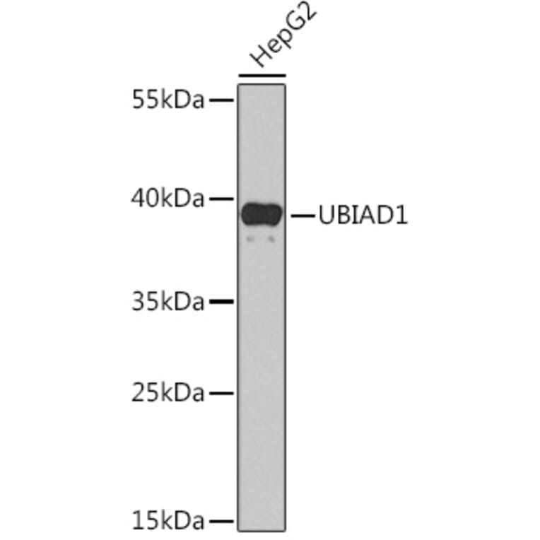 Western Blot - Anti-UBIAD1 Antibody (A91563) - Antibodies.com