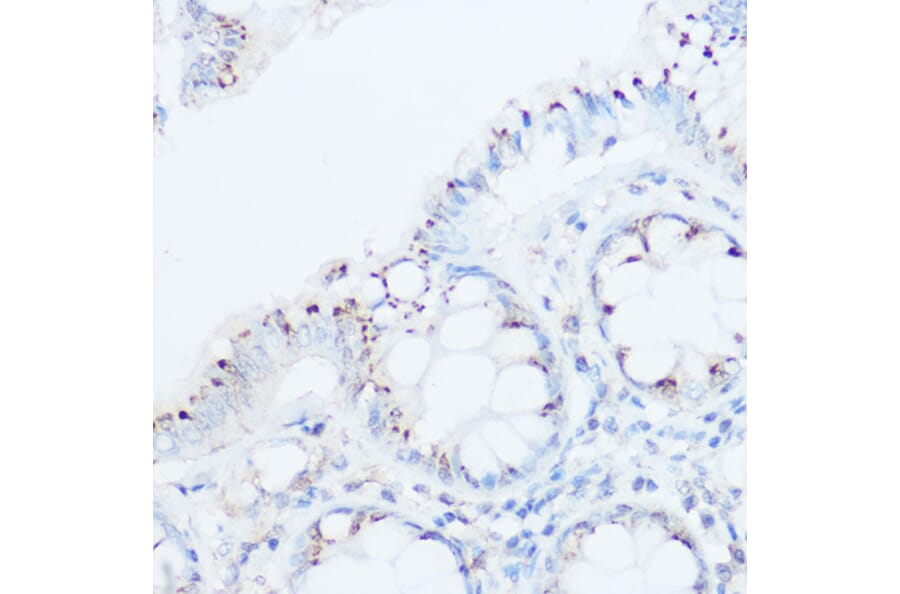 Immunohistochemistry - Anti-UBIAD1 Antibody (A91563) - Antibodies.com