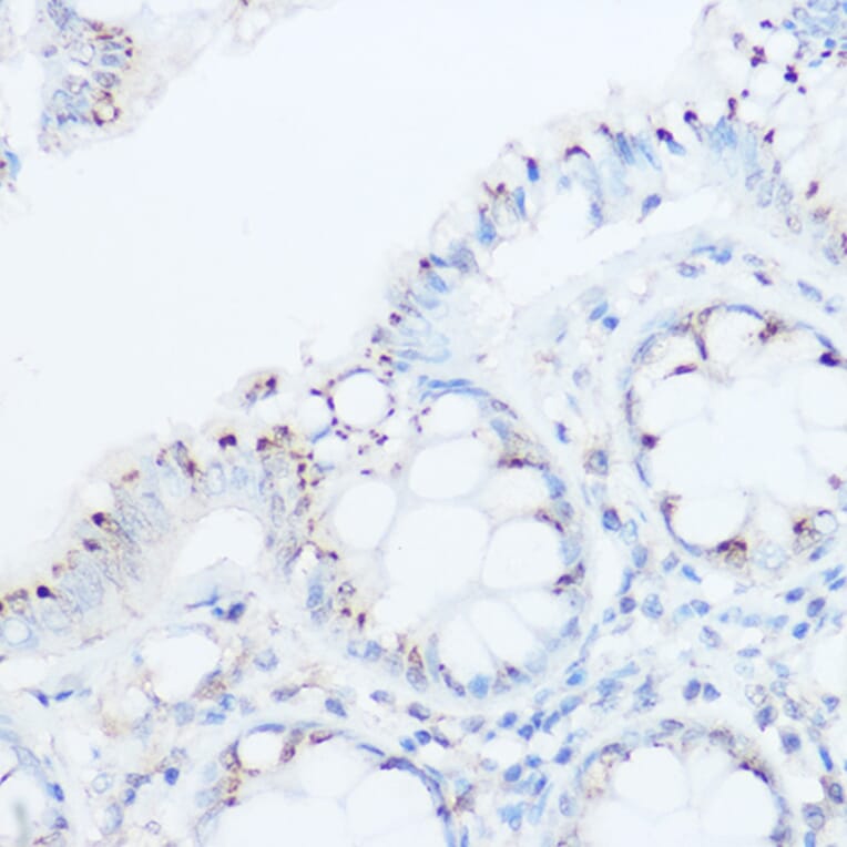 Immunohistochemistry - Anti-UBIAD1 Antibody (A91563) - Antibodies.com