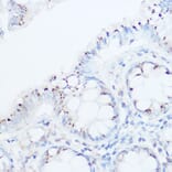 Immunohistochemistry - Anti-UBIAD1 Antibody (A91563) - Antibodies.com