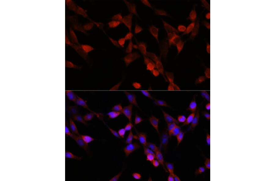 Immunofluorescence - Anti-UBIAD1 Antibody (A91563) - Antibodies.com